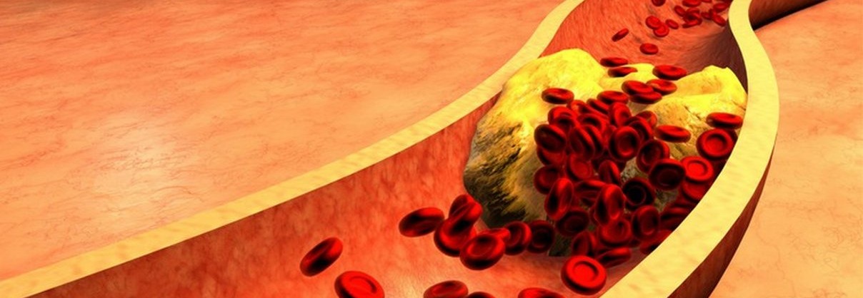 Cholesterol Reducing Food